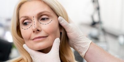 woman-getting-ready-nose-job-surgery